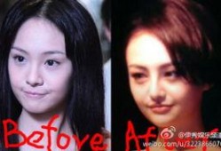 西安整容爆料事件始末视频,真相与争议的漩涡